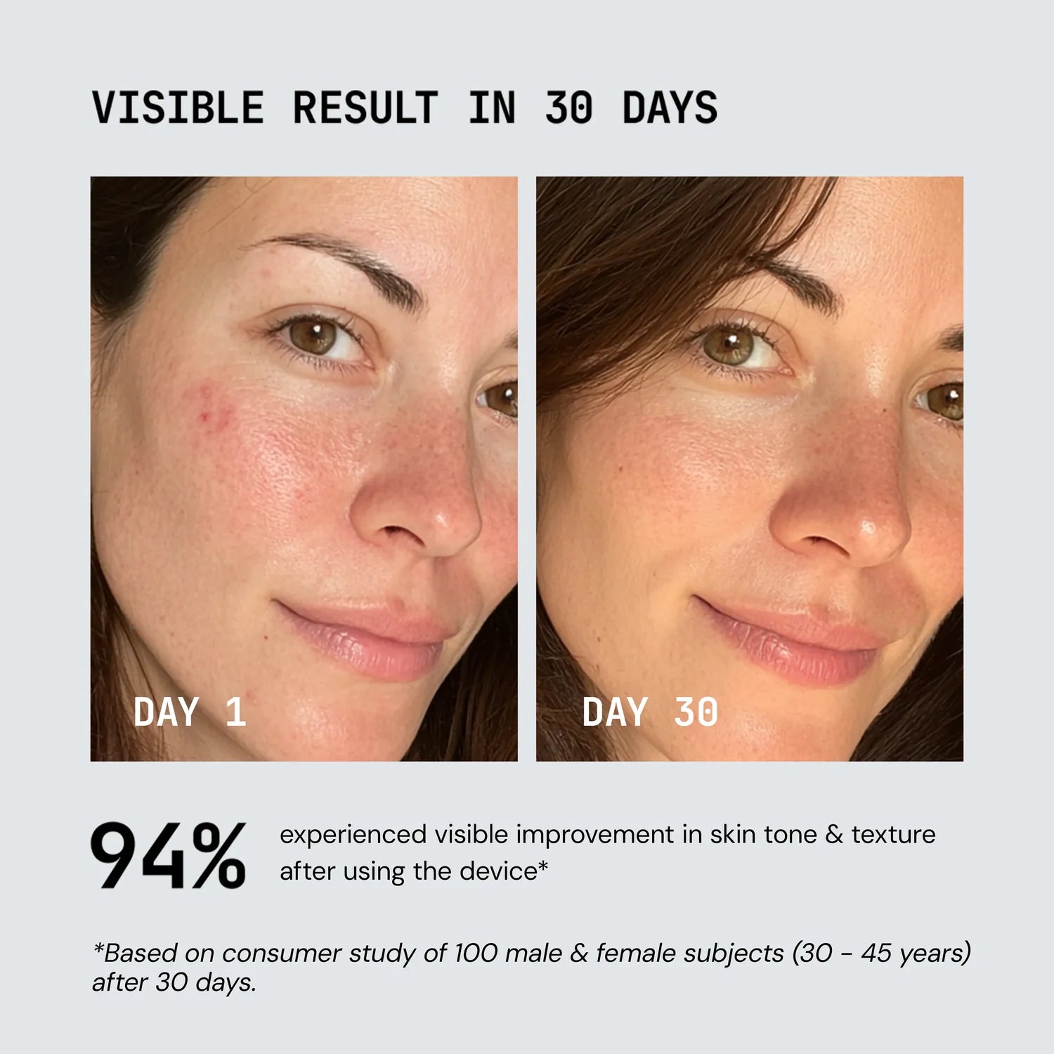 Dirella Red Light Therapy Device