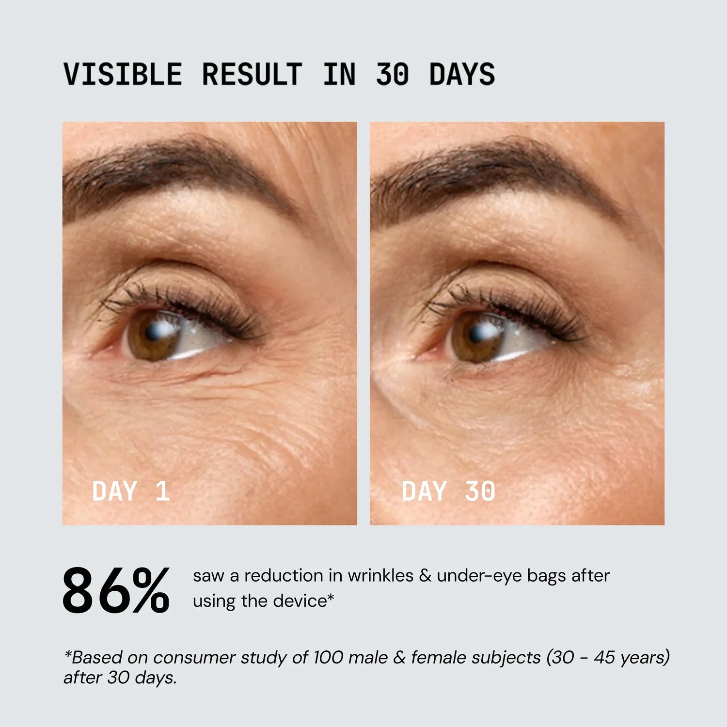 Dirella Red Light Therapy Device